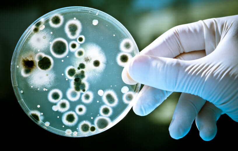 Person holding dish with bacteria in lab