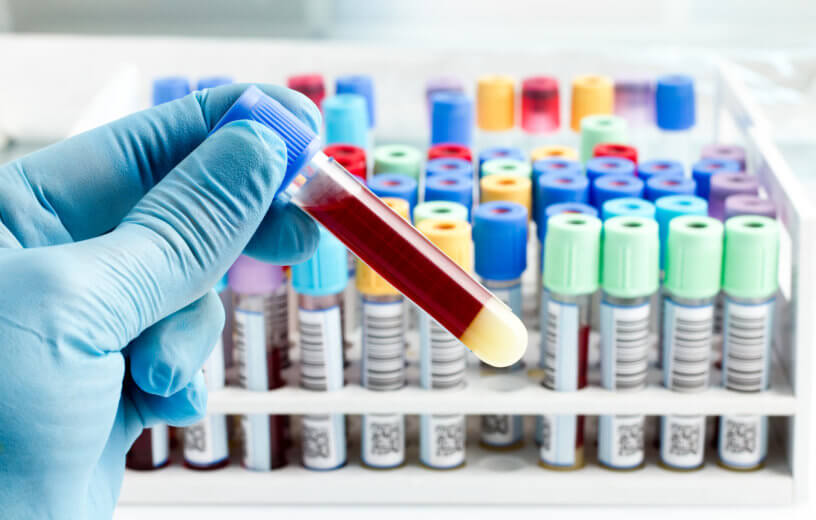 Lab technician holding a blood test tube