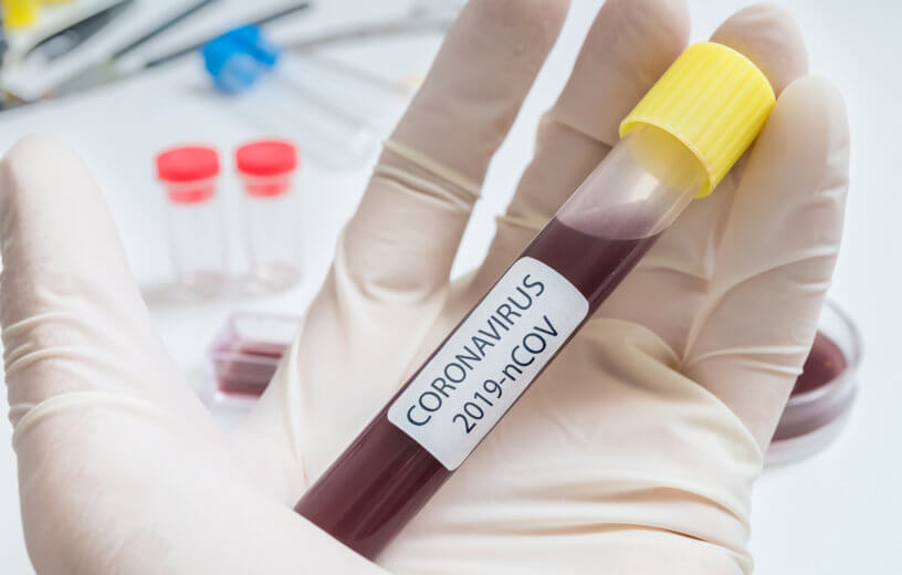 Coronavirus lab test