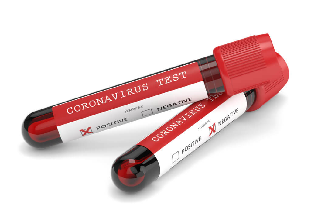 Coronavirus test tubes
