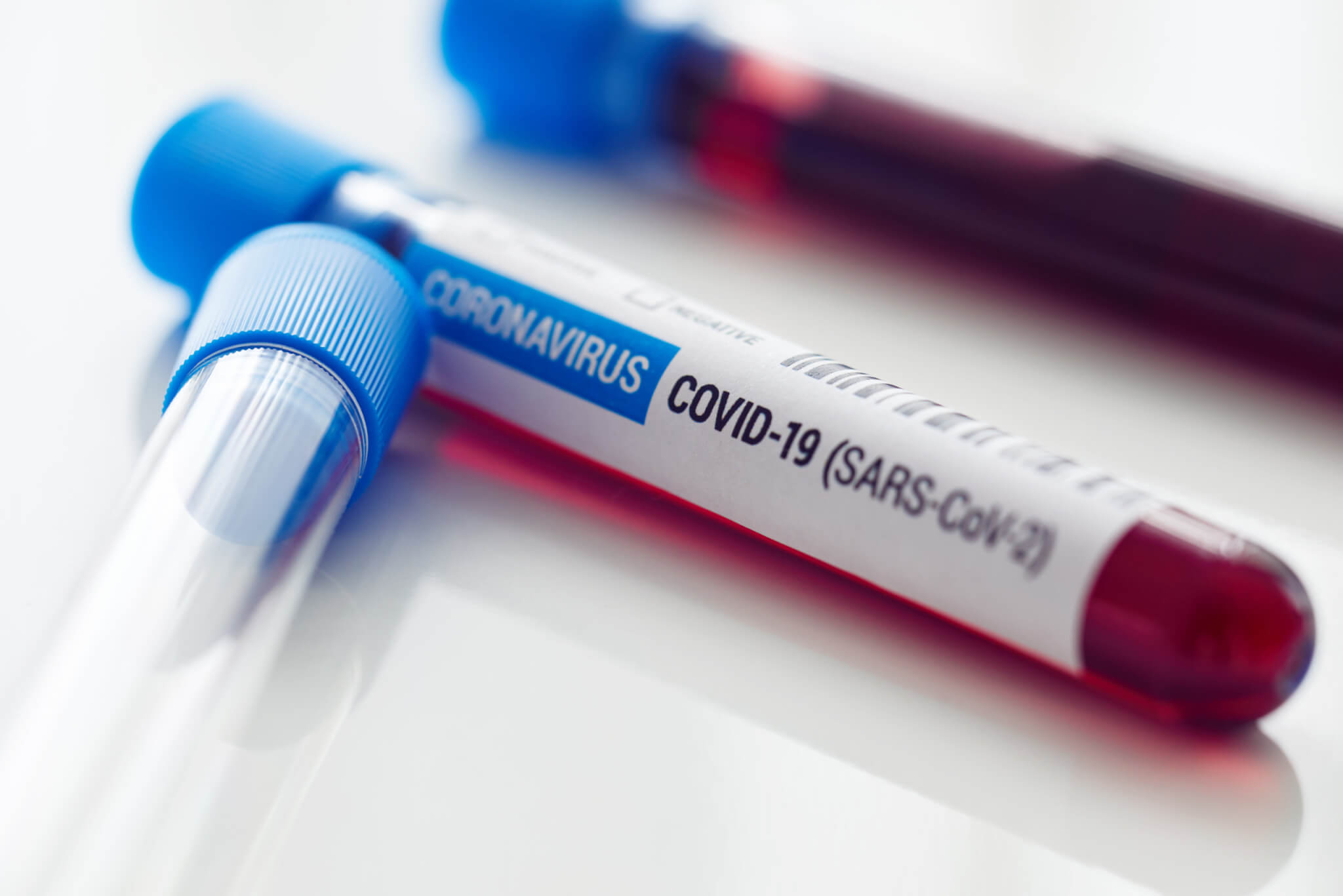 Immunity To COVID 19 Lasts Up To 8 Months After Infection Study Reveals