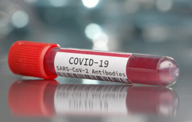 COVID-19 SARS-CoV-2 antibodies
