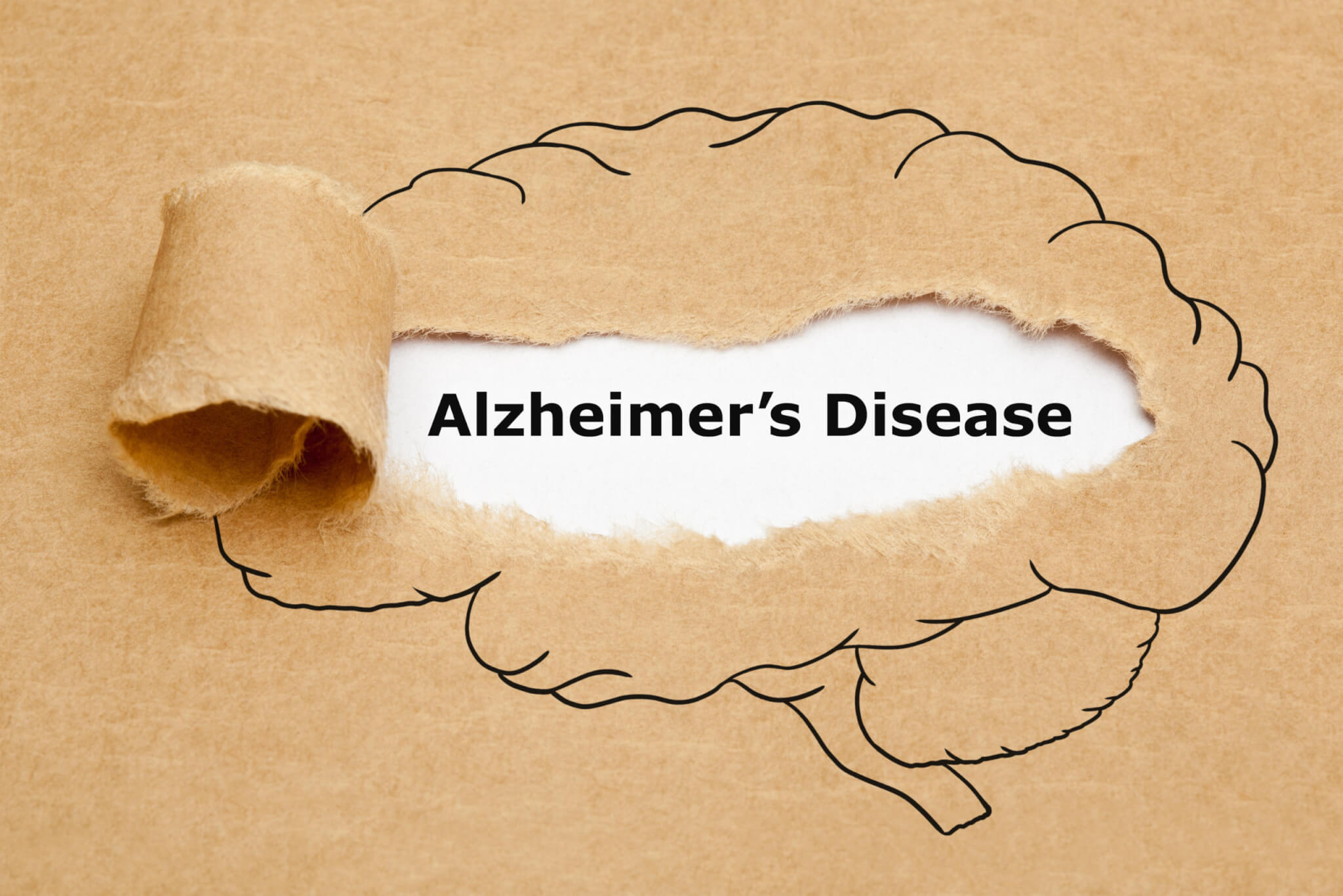 Alzheimer’s biomarker sparks warning about brain-boosting serine dietary supplements