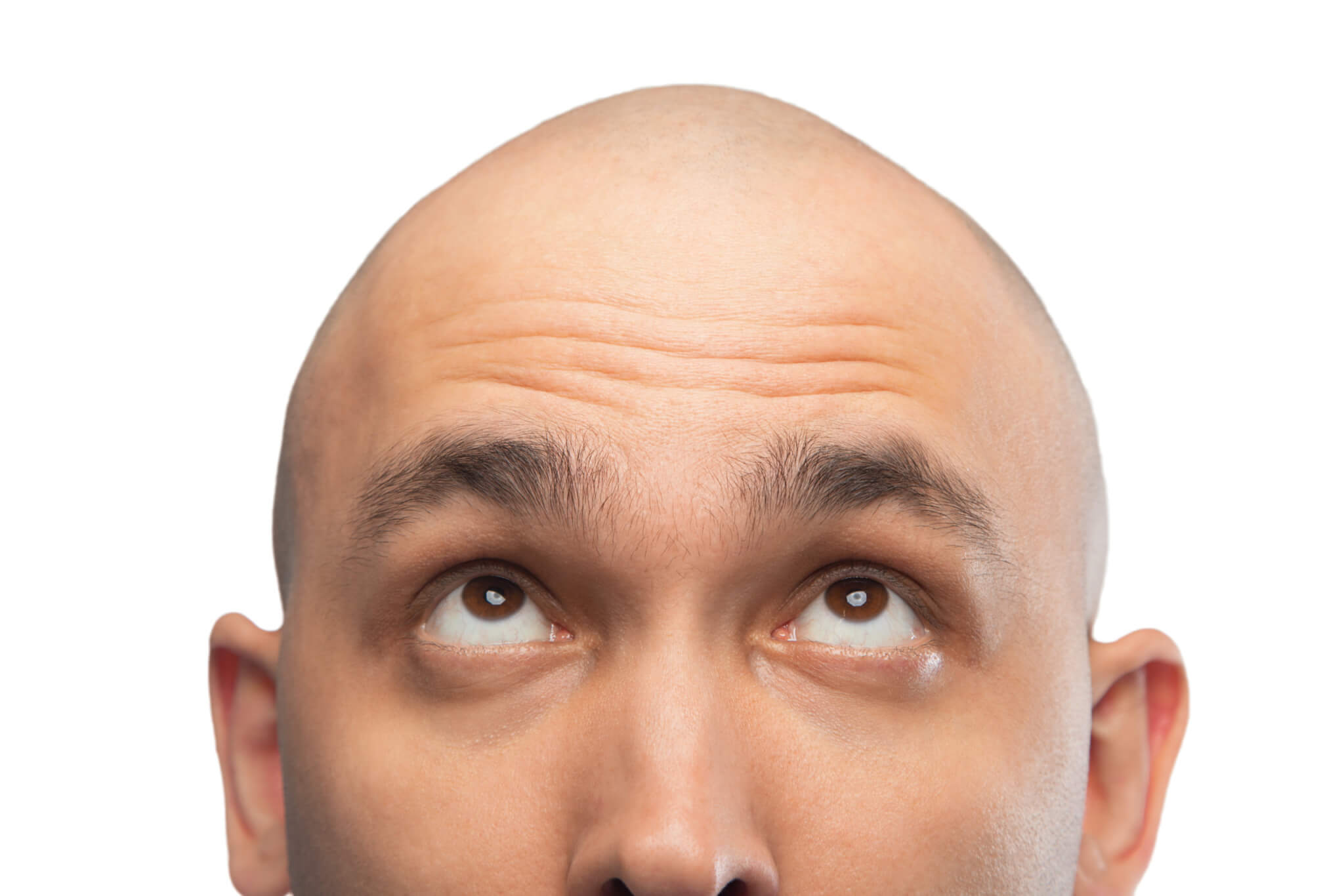 Baldness cure on horizon? Harvard scientists discover protein that fuels hair growth