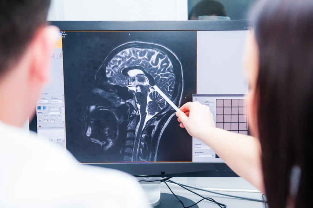 Brain scan