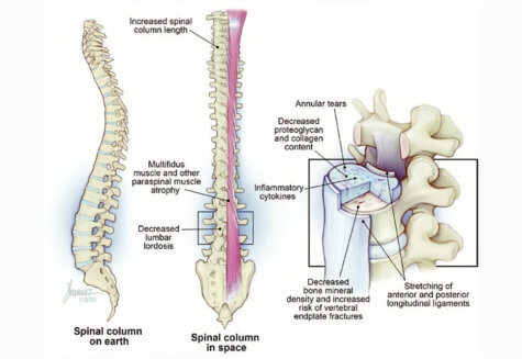 Astronauts spinal column