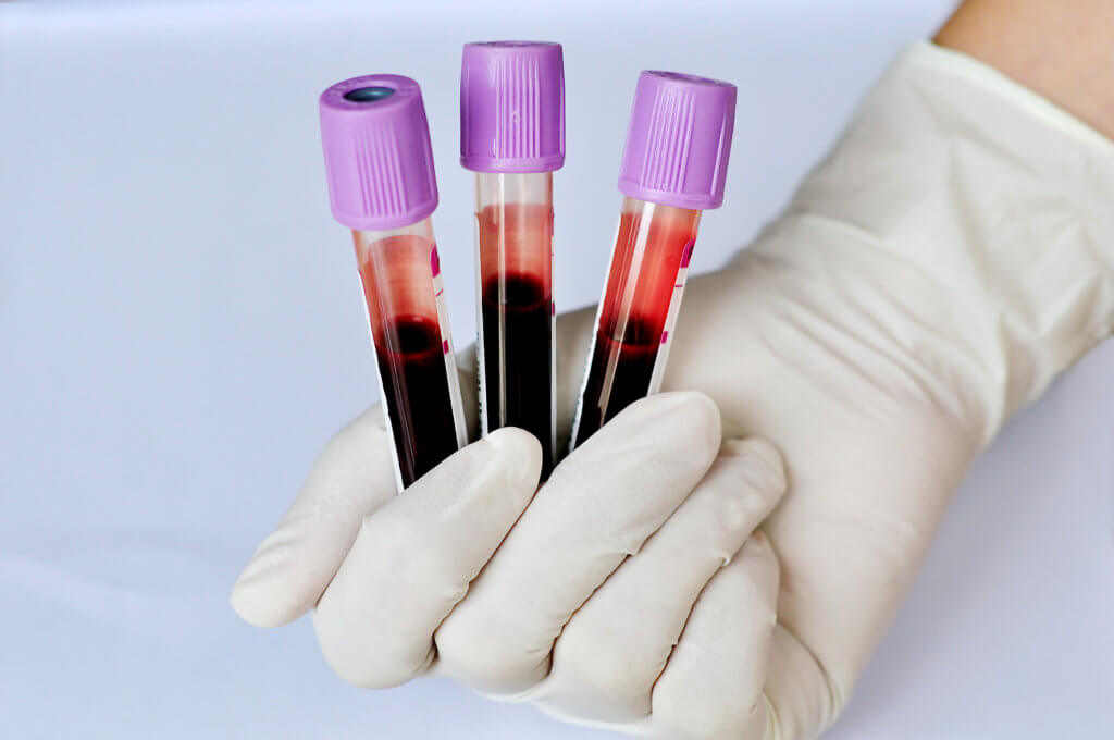Test tubes with blood