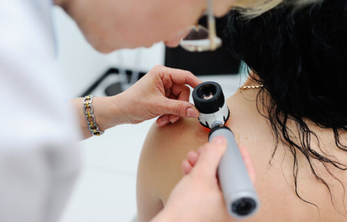Doctor looking at patient's mole for melanoma screening